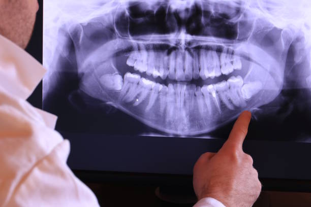 Best Dentist for Tooth Abscess  in Oak Park, CA